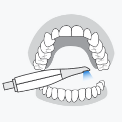 intraoral scanner cartoon