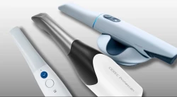 Why do you need an intraoral scanner in your dental practice?